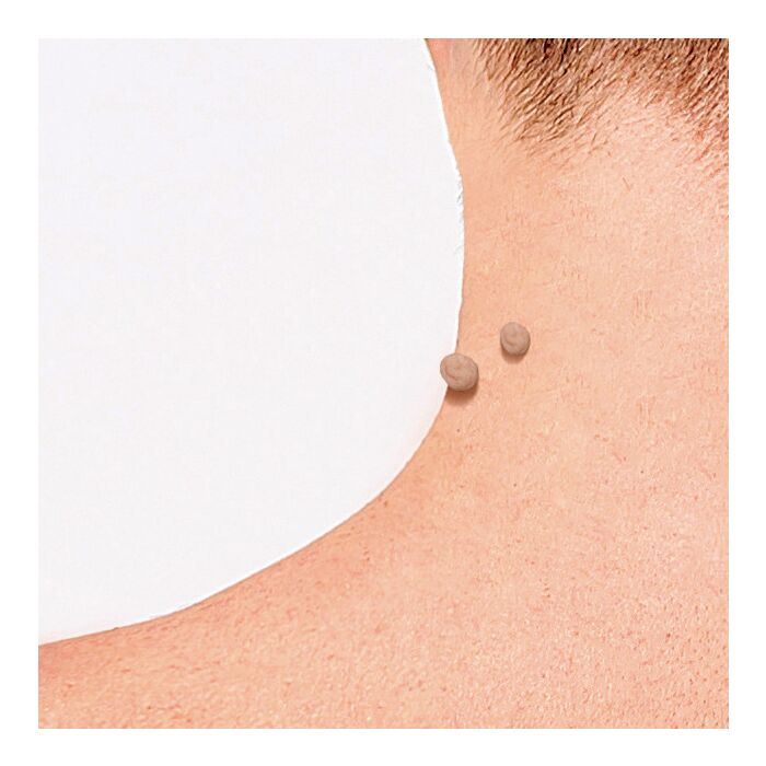 Formuclear Skin Tag Patch, Warzenpflaster, 30 Stück