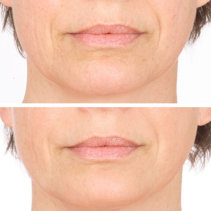 Vitame Collagen Plus gélules