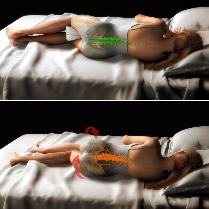 Restform Leg Pillow MD ergonomisches Beinkissen